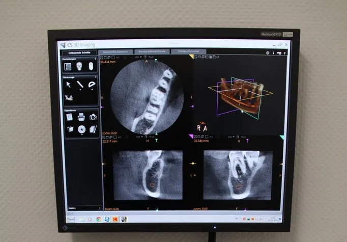 Monitor in der Praxis mit DVT-Auswertung: Schichtbilder und 3D-Ansicht
